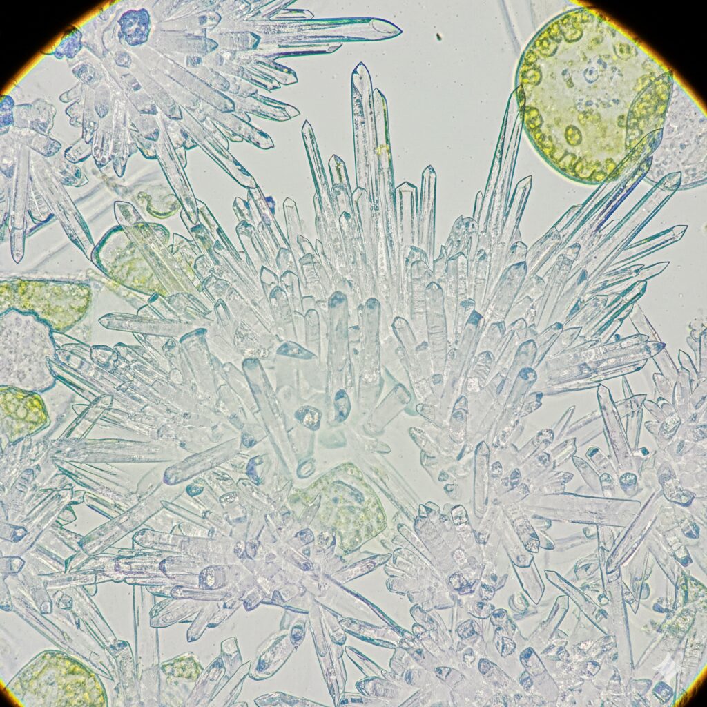 フリージア 毒性3 フリージアの組織内に含まれる鋭利なシュウ酸カルシウム針状結晶の顕微鏡写真イメージ